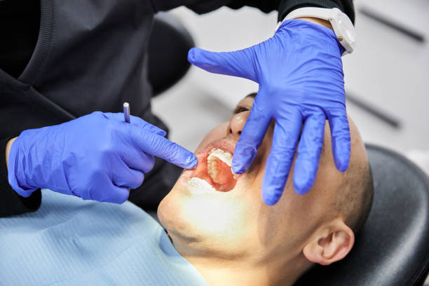 Best Emergency Gum Pain Relief  in Fenton, MO