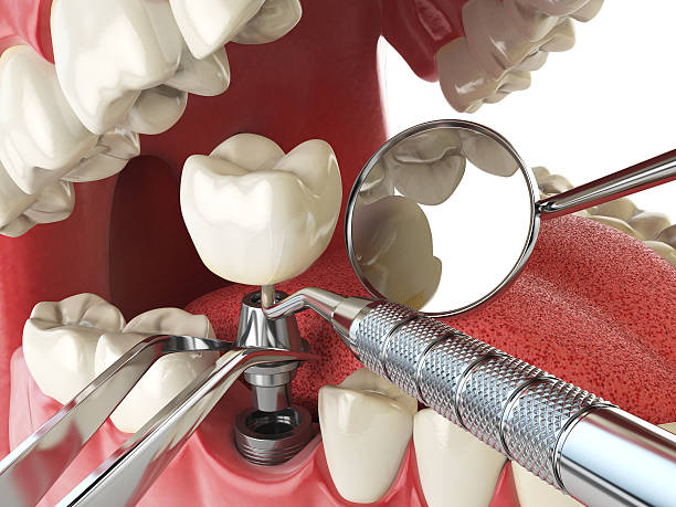 Best Tooth Pain Emergency Relief  in Fenton, MO